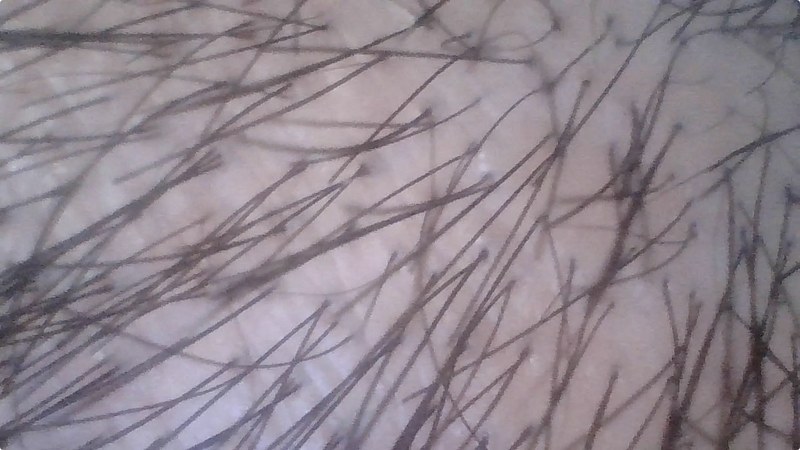 これもQuickTime Playerで撮った動画の切り出しです。左から、指先、頭皮付近、歯。