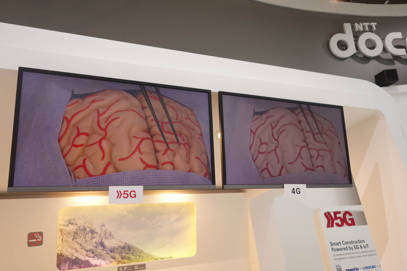 映像比較。5Gの方が情報量が増えるので、全体的にキレイになる