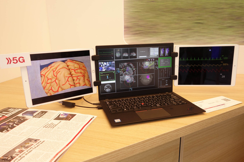 遠隔地から監修する専門医側のイメージ。同時に各種バイタルデータなども送っている