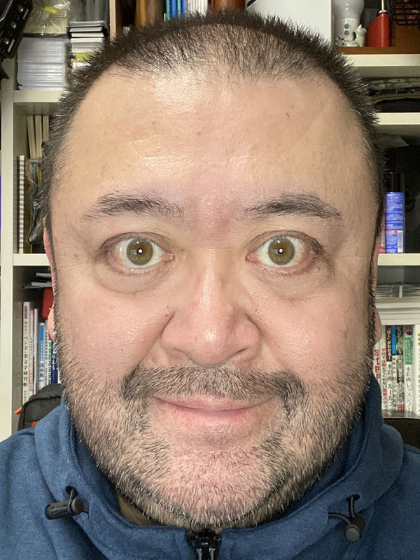 小さいほうのリングライトをスマホに装着して自撮りした様子。左がライトがオフで、右がライトがオン。むさ苦しい顔で恐縮ですが、リングライトを使って撮ると顔全体が明快に写り、さらに目にリング状のキャッチライトが入り、シワが軽減されたりもして、より好印象な自撮り写真が得られます。