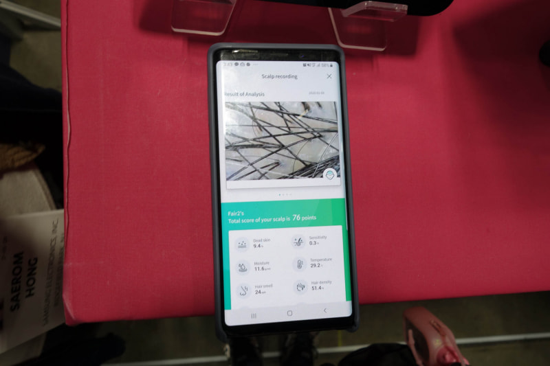 測定結果。頭皮の写真と各種数値が表示される。生え際が気になるお年頃の筆者だが、密度は申し分ないとのこと。良かった……
