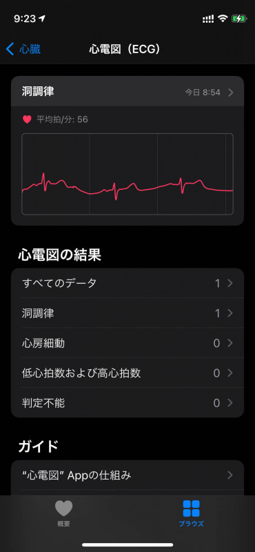 心電図の記録。「洞調律」は問題のない。「心房細動」が問題ありで、「低心拍数」や「高心拍数」、「判定不能」は計測に問題があったのかも