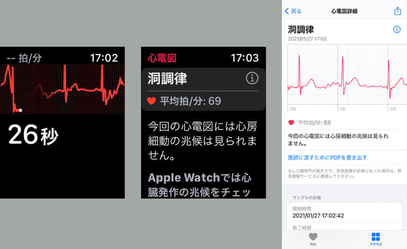 Apple Watchでの心電図取得は約30秒で済む。その場で結果がわかり、心房細動の兆候がないことも確認できる。また、Apple WatchとペアリングしているiPhone上のヘルスケアアプリで心電図の詳細を見ることもできる。