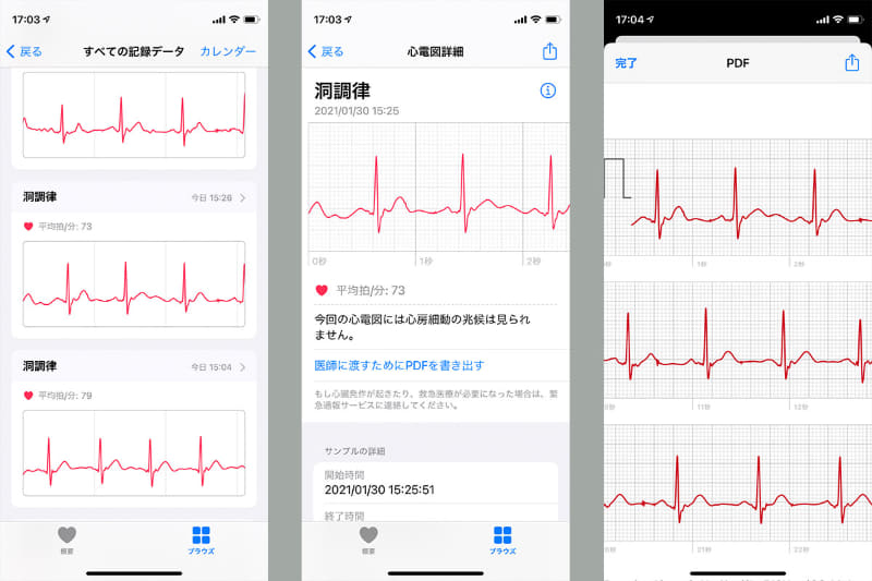 ヘルスケアアプリで取得した心電図をブラウズしている様子。ひとつの心電図を開き、「医師に渡すためにPDFを書き出す」からその心電図の詳細を見ることもできる。右は心電図PDFを精査している様子。もちろん拡大・縮小して表示できる。横画面表示も可能。