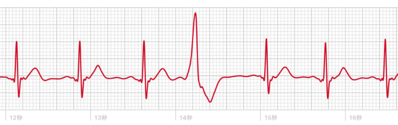拡大してみると……やっぱりほかと明らかに違う!!!　カタチも位置も違う!!!