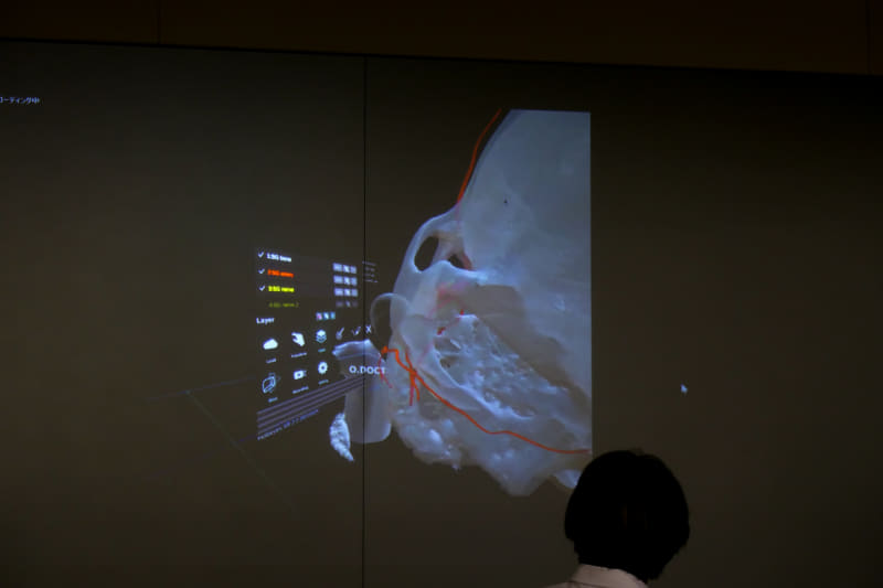 血管は赤い線で示されている