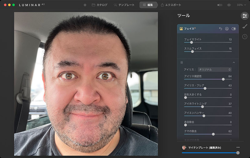 Luminar AIのフェイスAI機能やスキンAI機能を使い、顔をわずかに細くし、目を白くさせつつキャッチライトも増やし、目の下のクマを少々緩和し、肌の湿疹や荒れを減らして、さらに背景を少しボカしたもの