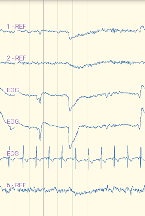 左＝脳波系装着図　右＝動画視聴中の脳波