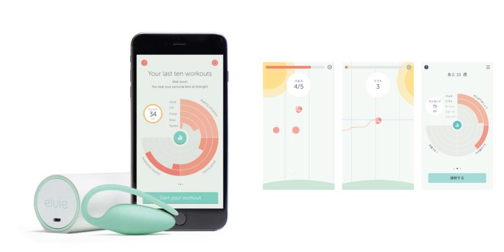 エルビートレイナー