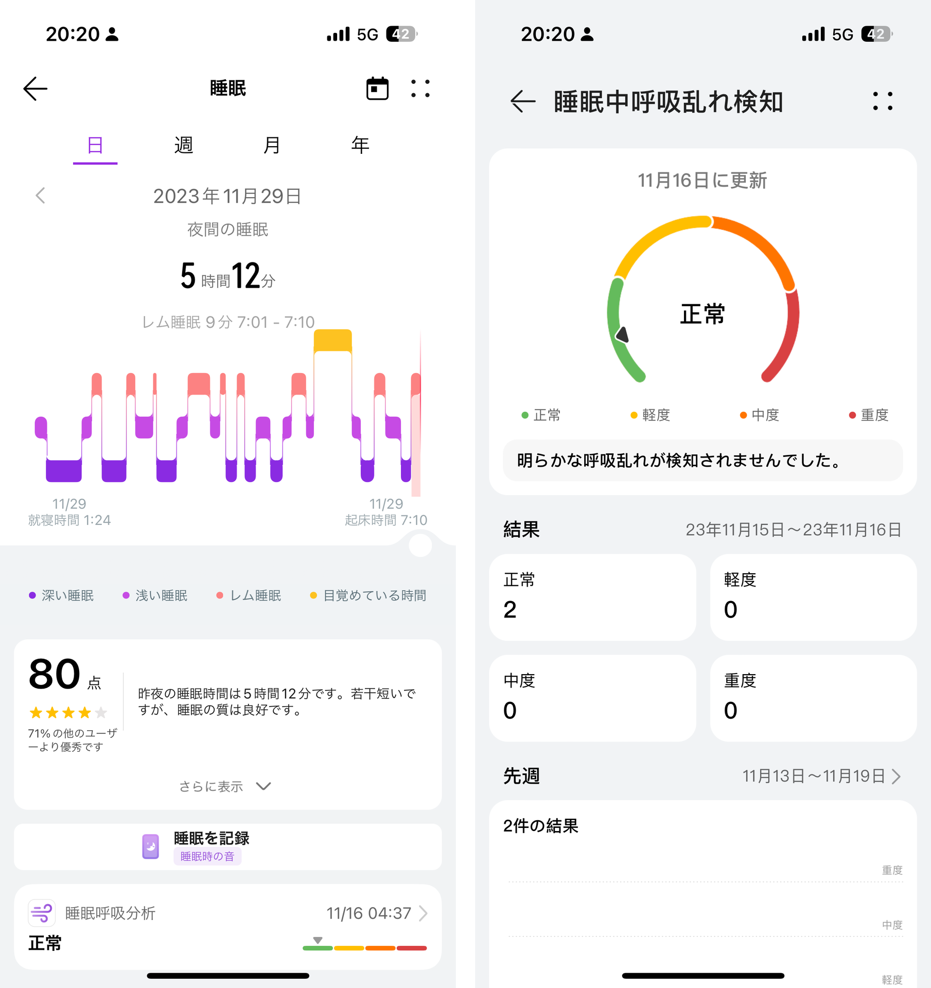 睡眠の質が点数で表示されるのがわかりやすい。睡眠中の呼吸の乱れを検出する機能も搭載
