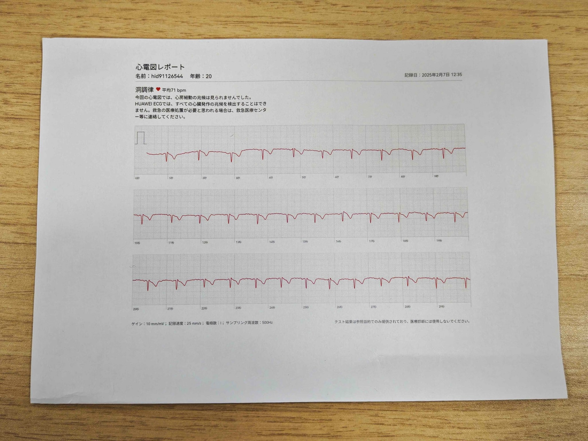 心電図は印刷して医師と共有することもできる