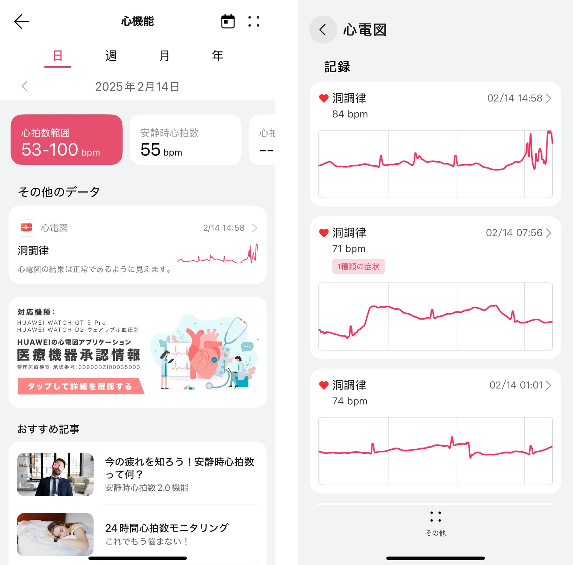 測定した心電図は「HUAWEI Health」アプリで確認できる。「ヘルスケア」画面の「心機能」→「心電図」、または「デバイス」画面でウォッチを選択し、「心電図」をタップすると表示される