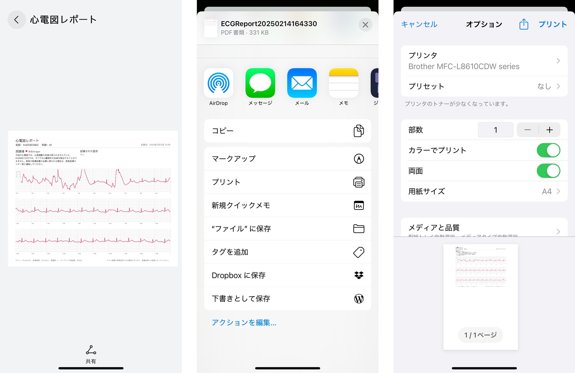 記録された心電図を選択し、プリントすることも可能