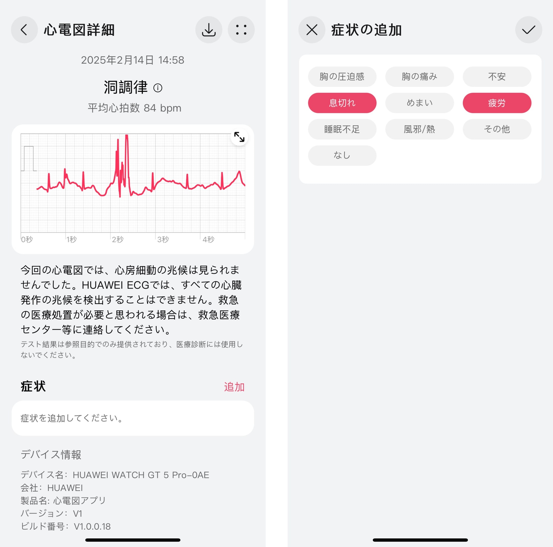 「HUAWEI Health」アプリの「心電図詳細」画面で追加することもできる