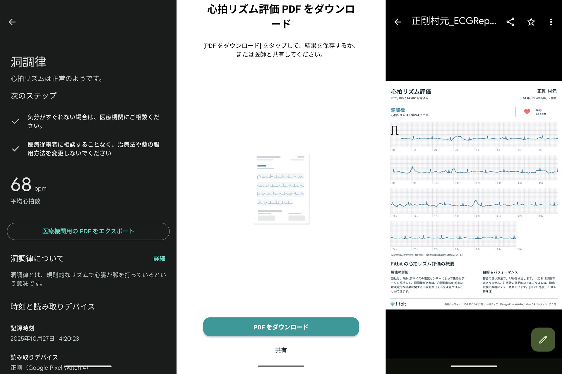 詳細結果の「医療機関用のPDFをエクスポート」をタップすると、心電図レポートを共有したり、プリントしたりできる画面に進む
