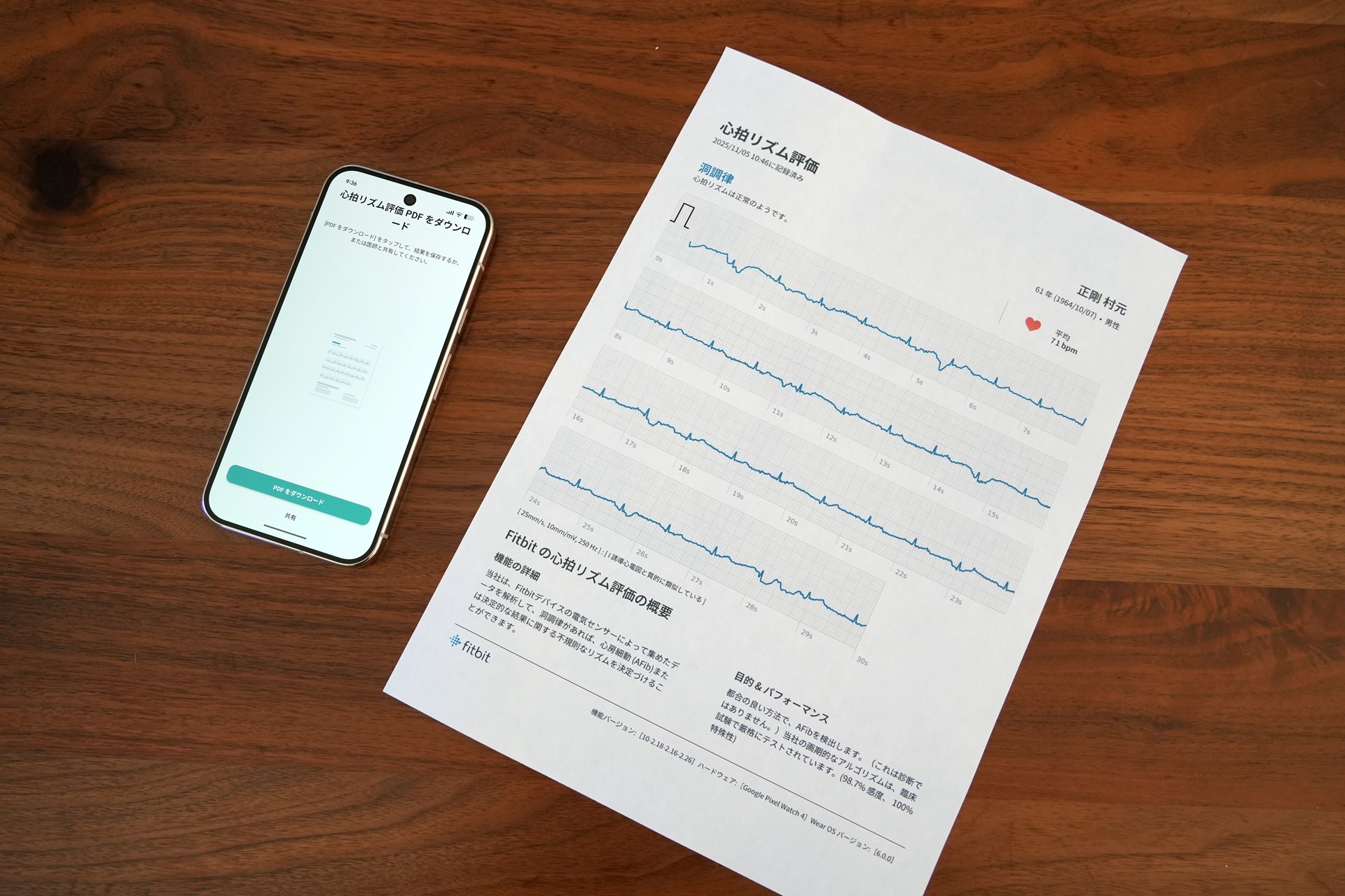 30秒間の心拍リズムを示す図をプリントアウトできる