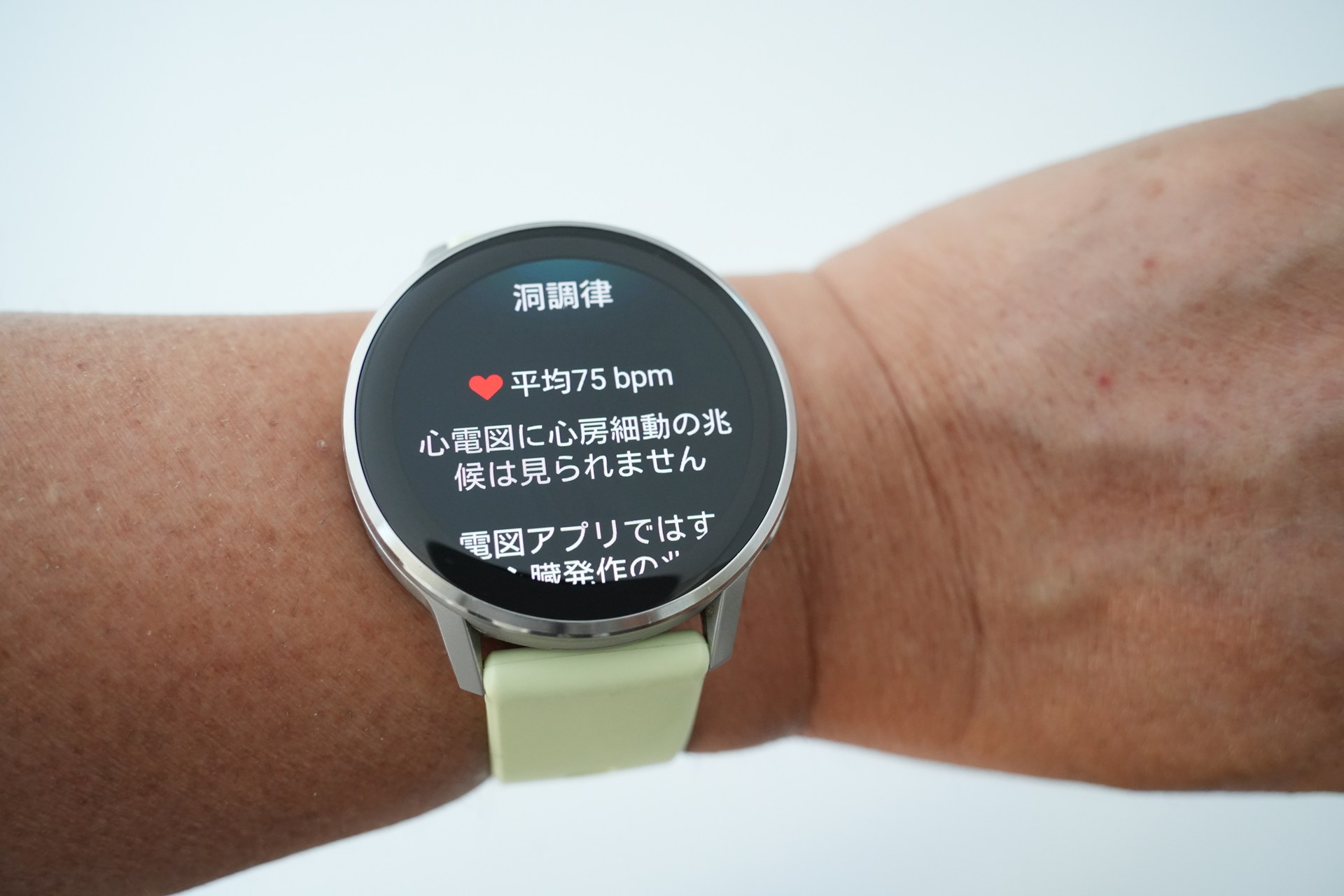 異常がない場合は「洞調律」と表示される