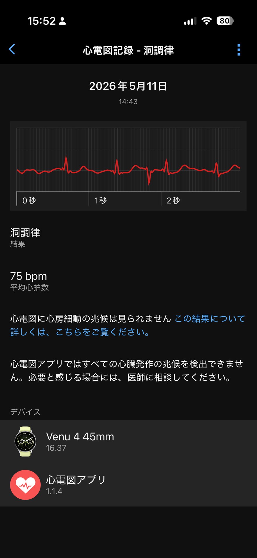 測定結果はスマホに同期され、「Garmin Connect」アプリで詳細な結果を見られる。PDFにして医師と共有することも可能