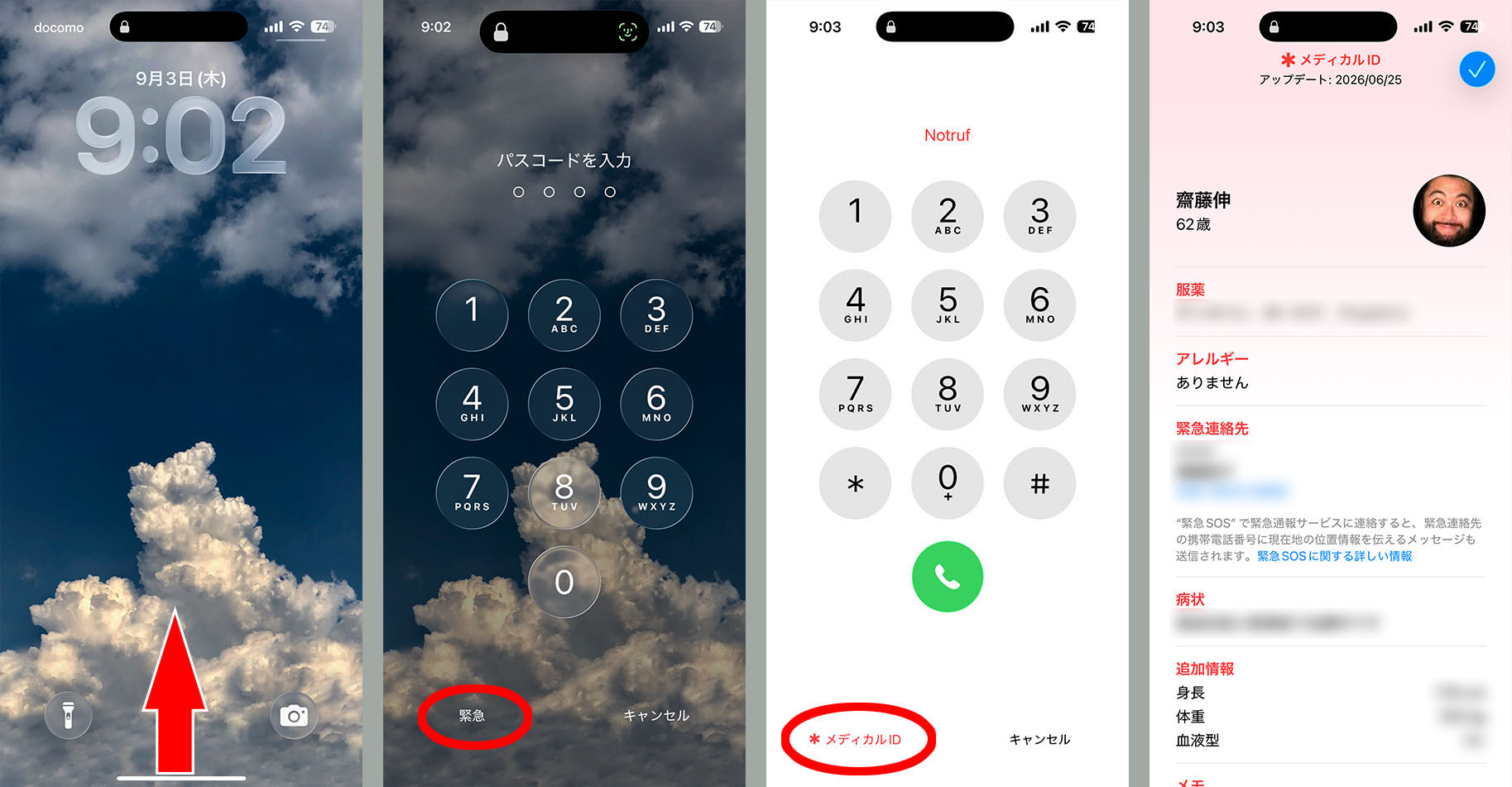 メディカルIDを既にiPhone上に登録している場合、ロック画面からの操作で内容を表示できる。ロック画面で画面を上にスワイプ（もしくはホームボタンを押下）し、「緊急」→「＊メディカルID」の順にタップしていけば登録されている情報（メディカルID）が表示される。これ以外の表示方法もあるが、恐らくこの方法が医療関係者などに広く周知されているものだと思う。