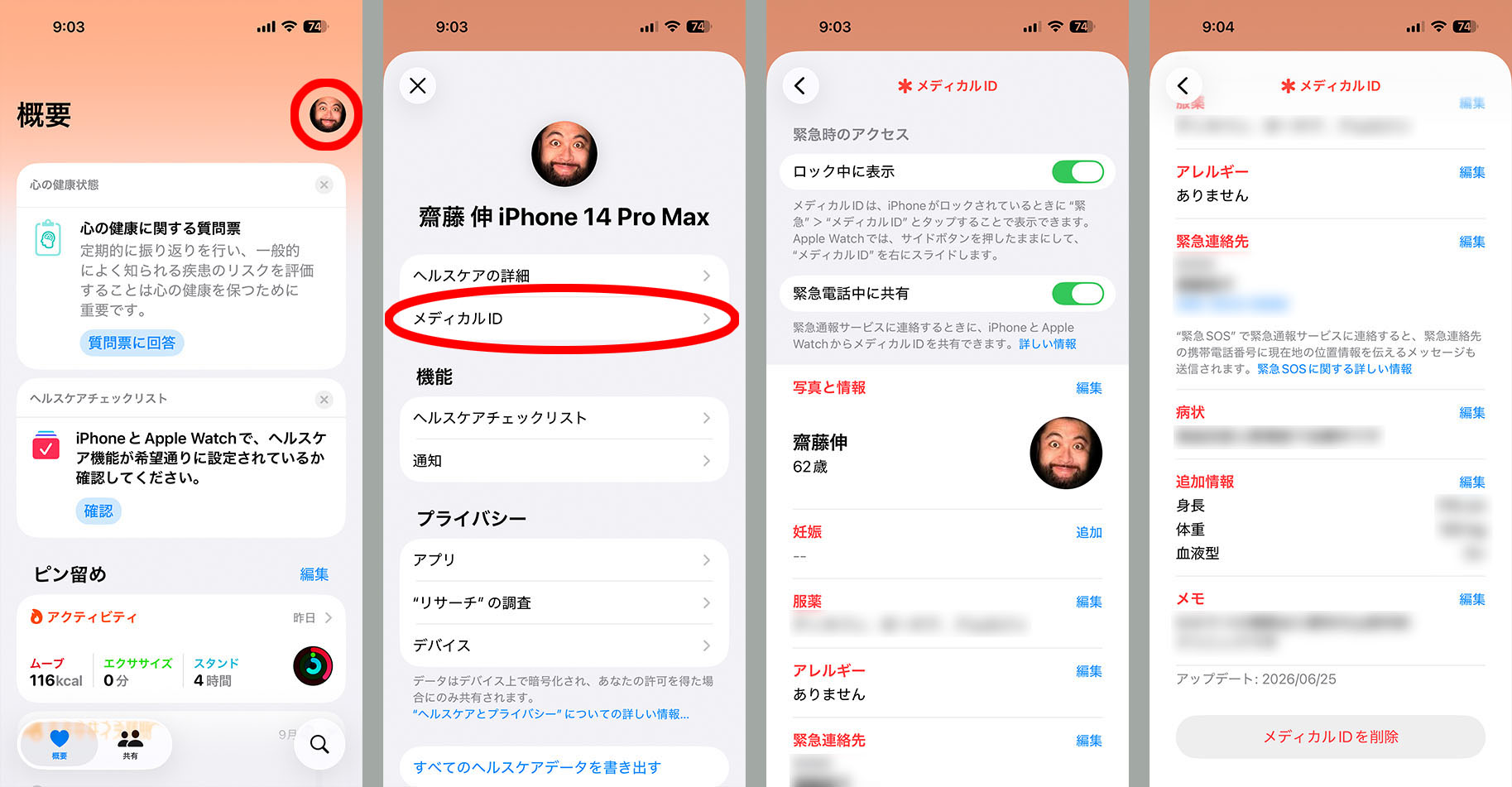 メディカルIDはiPhoneのヘルスケアアプリから登録・編集できる。緊急時に必要になる個人情報を登録可能。スクリーンショット3枚目の「ロック中に表示」をオフにしておけば、iPhoneをロック解除しない限りメディカルIDは表示されなくなる。リスクが高い行動を取るときだけ「ロック中に表示」をオンにするといった使い方もできる。