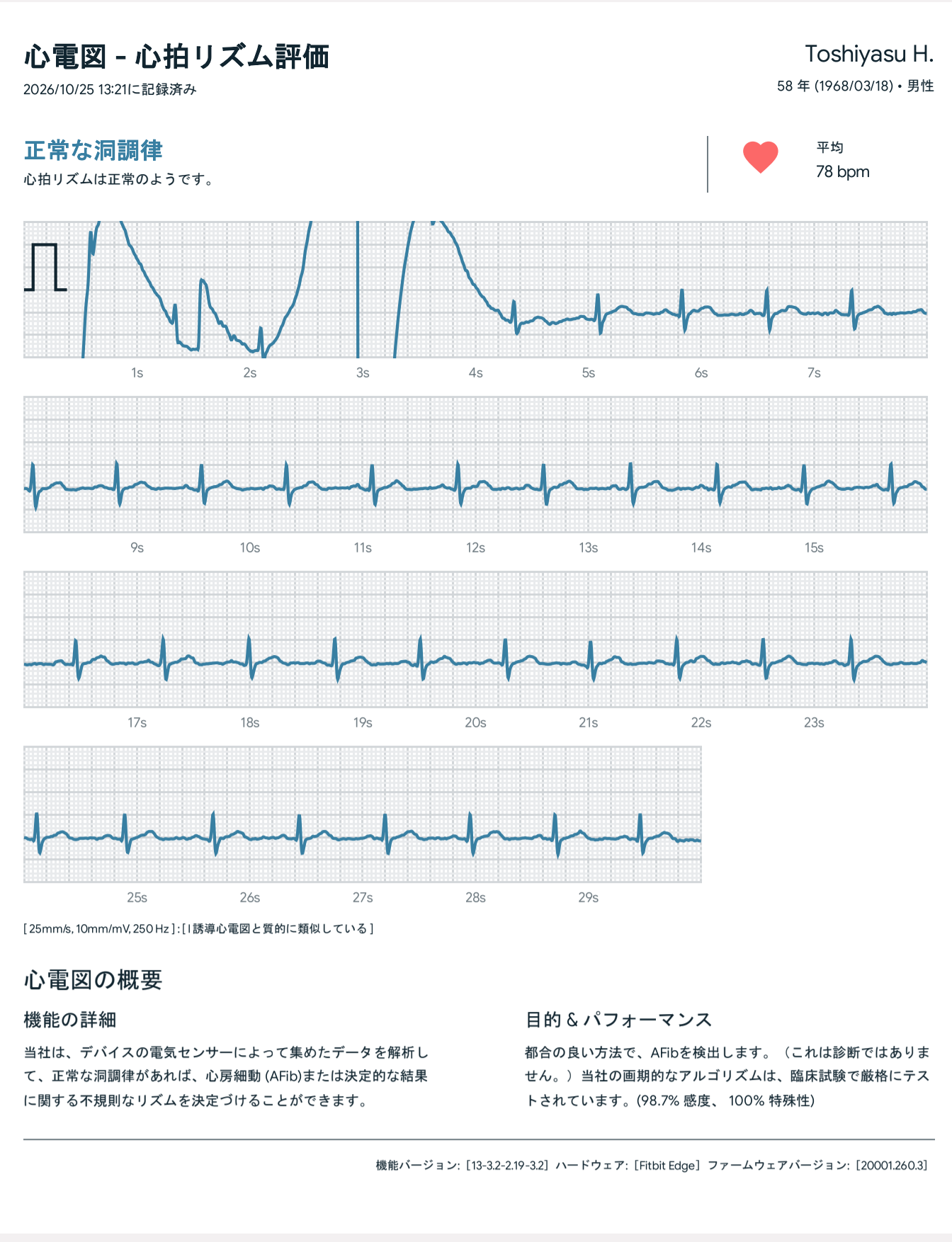 計測した心電図はPDF形式で出力可能