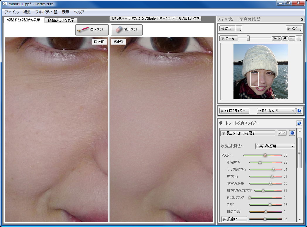 気になる部分をスライダー操作でさらに修正することができる。たとえば[肌コントロール]の各スライダーを動かせば、シワや毛穴を消したり肌を滑らかにできる。強力な「吹き出物自動除去機能」も使える