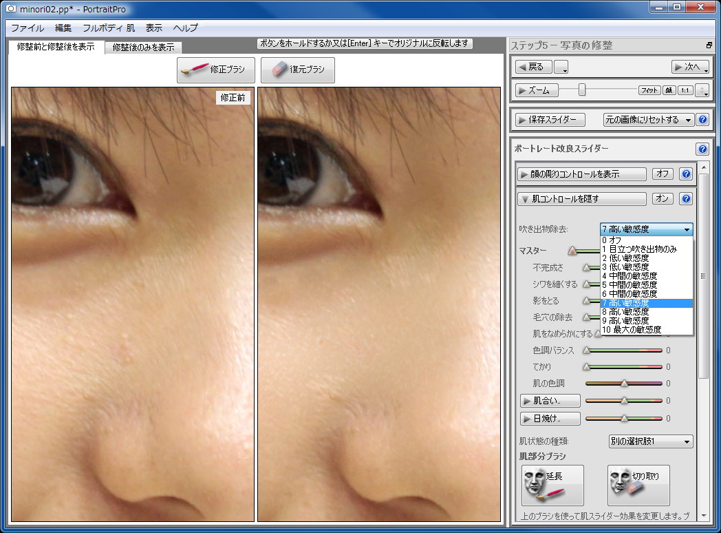 吹き出物除去機能を使えば、設定した強度に応じて吹き出物などを自動的に除去することができる。けっこー強力な機能だ