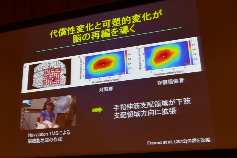 障害後に脳に起こる代償性変化と可塑性変化