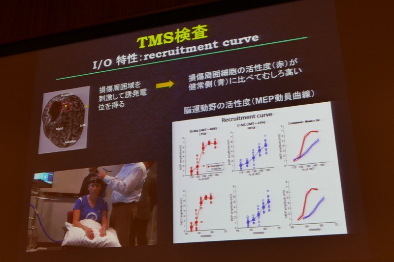 細胞周囲の活動活性度が高いことが明らかに