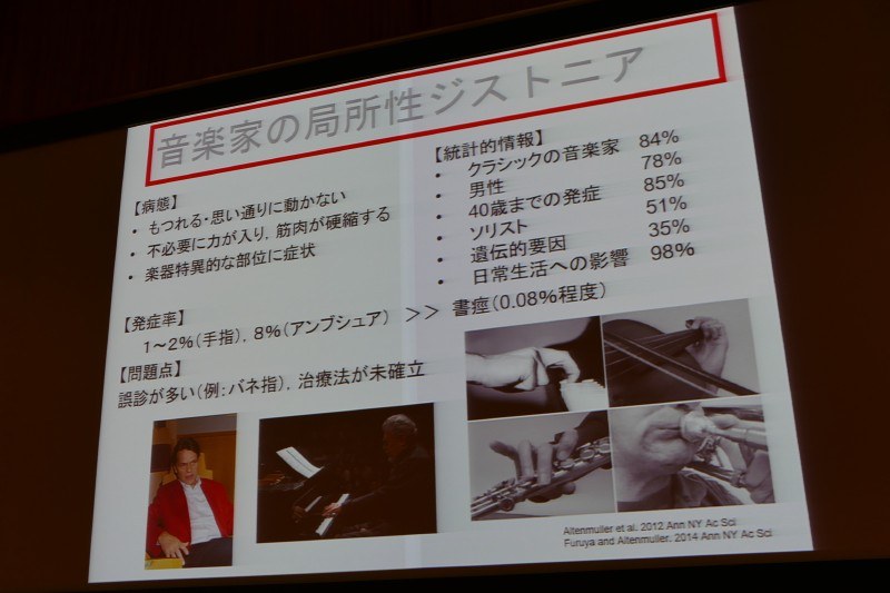 音楽家のジストニア