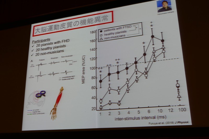 大脳運動皮質の機能異常と考えられている