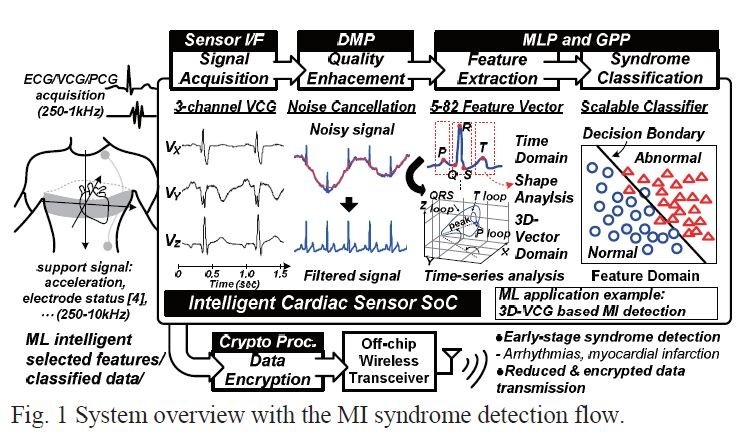 機械学習を利用したプロセッサ(SoC)の応用例。携帯型心電モニターが心筋梗塞(MI)を検知する様子。国立交通大学を中心とする研究チームが2013年のVLSIシンポジウムで発表した論文(論文番号C20-3)から