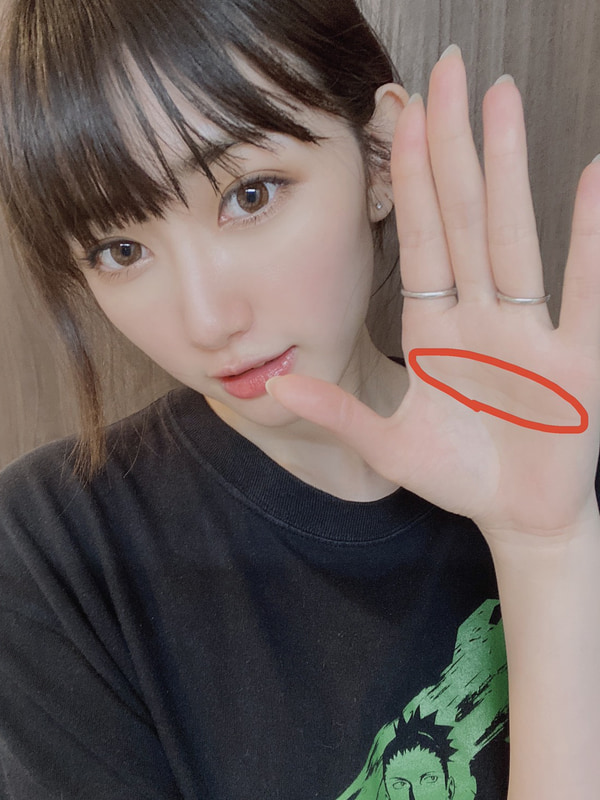 筆者の手のひらに刻まれたマスカケ線!