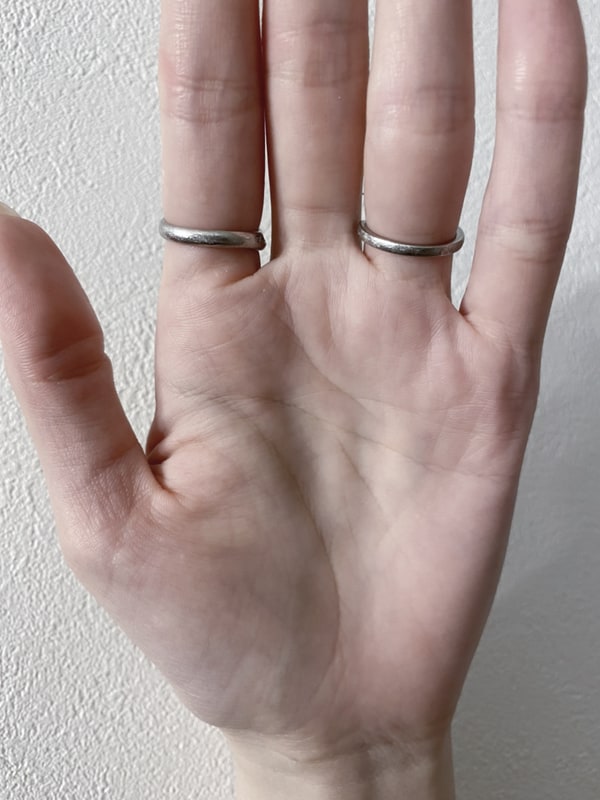 筆者の手のひらに刻まれたマスカケ線!