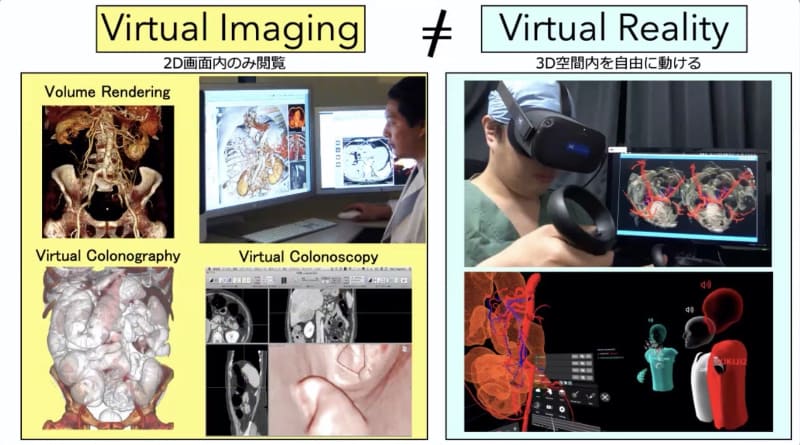 「Virtual Imaging」と「Virtual Reality」の違い