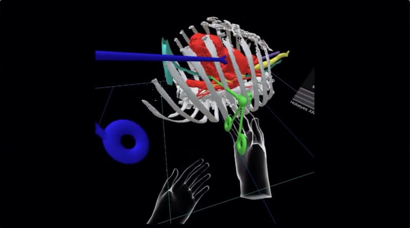 手術のシミュレーションも可能
