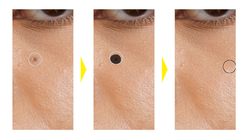 ここから「スポット修復ブラシツール」、「削除ツール」、「修復ブラシツール」、「コピースタンプツール」を使って処理していきます。「スポット修復ブラシツール」で消したい部分をドラッグして塗りつぶすと自然に消すことができます