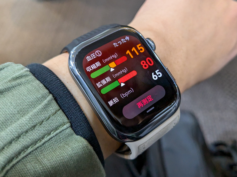 血圧測定の様子