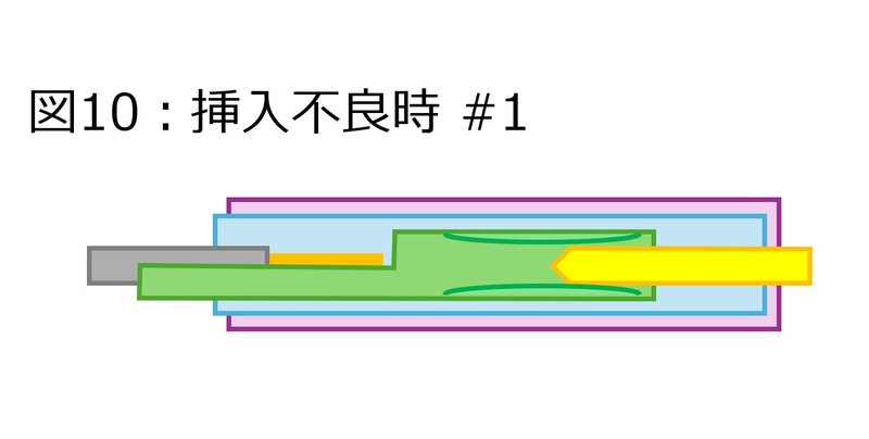 【図10】挿入不良時のケース1