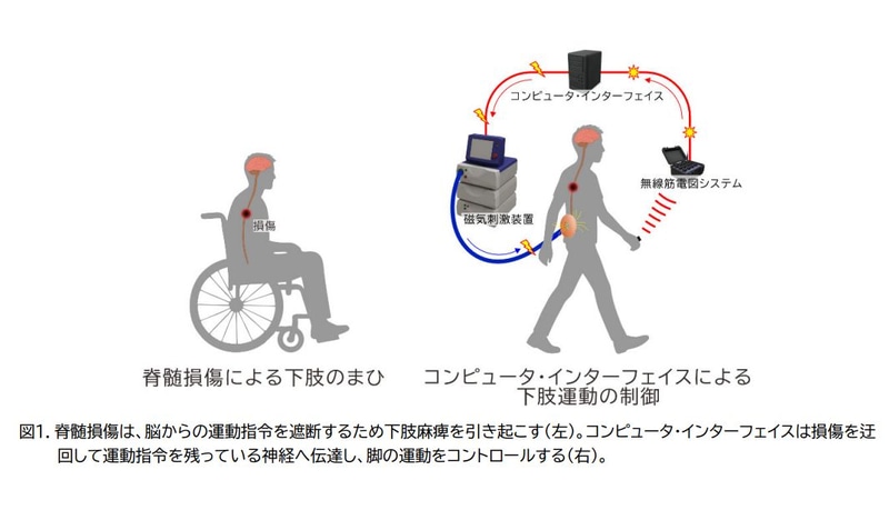 脊髄損傷による麻痺の発生と、人工神経接続システムの概略図