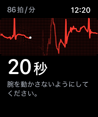 Apple Watchの心電図機能