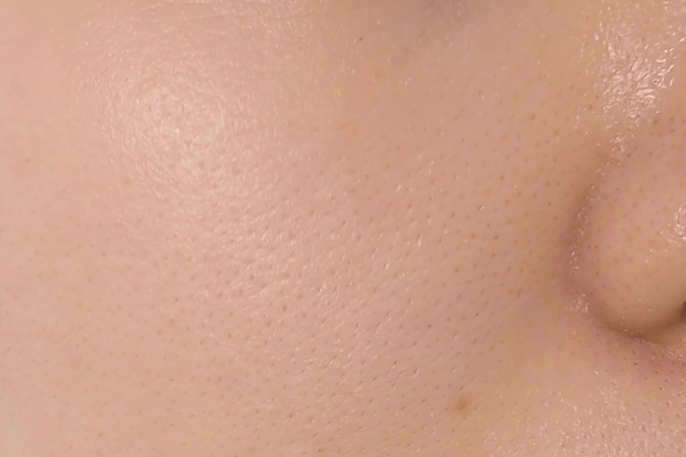 こちらが写真モードで撮影した顔の肌