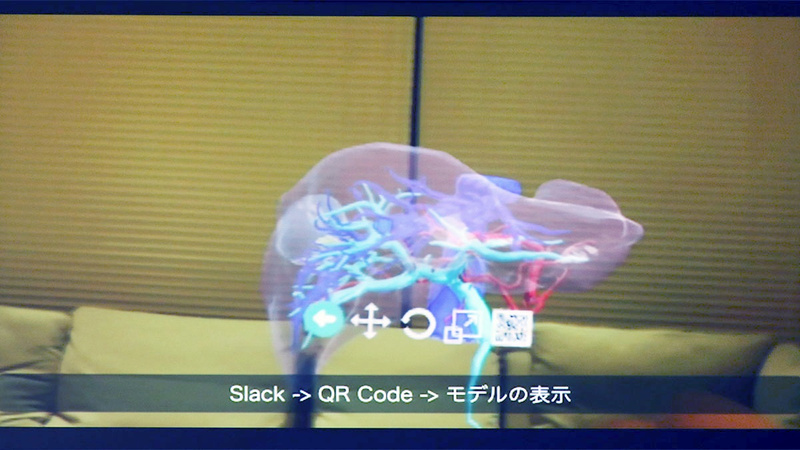 Holoeyesの紹介。空間にCTスキャンから作成した臓器のオブジェクトが現れる